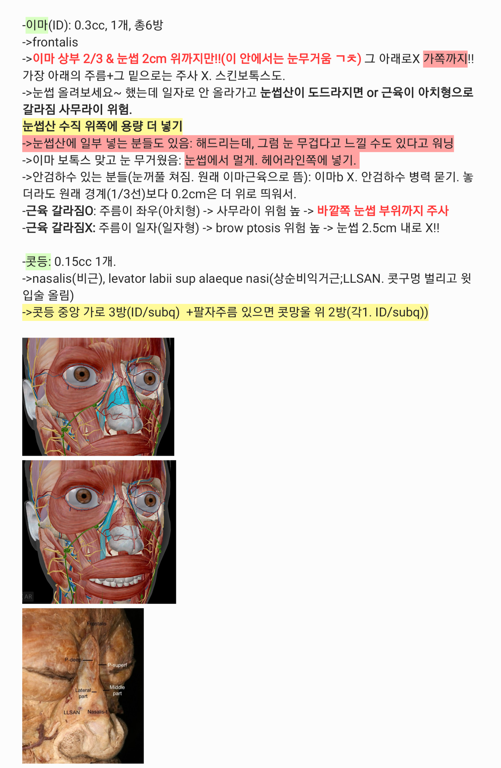 이마/콧등 근육 해부도