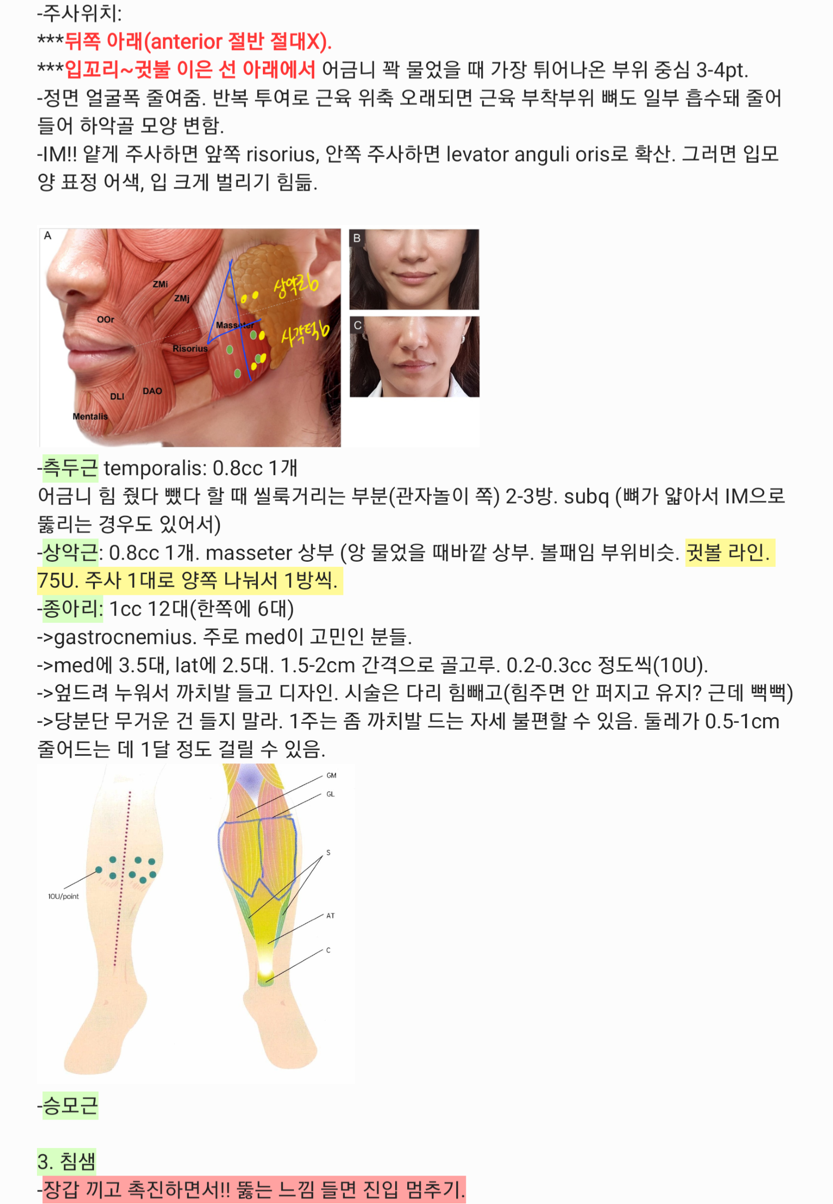 사각턱 전후 + 종아리 디자인