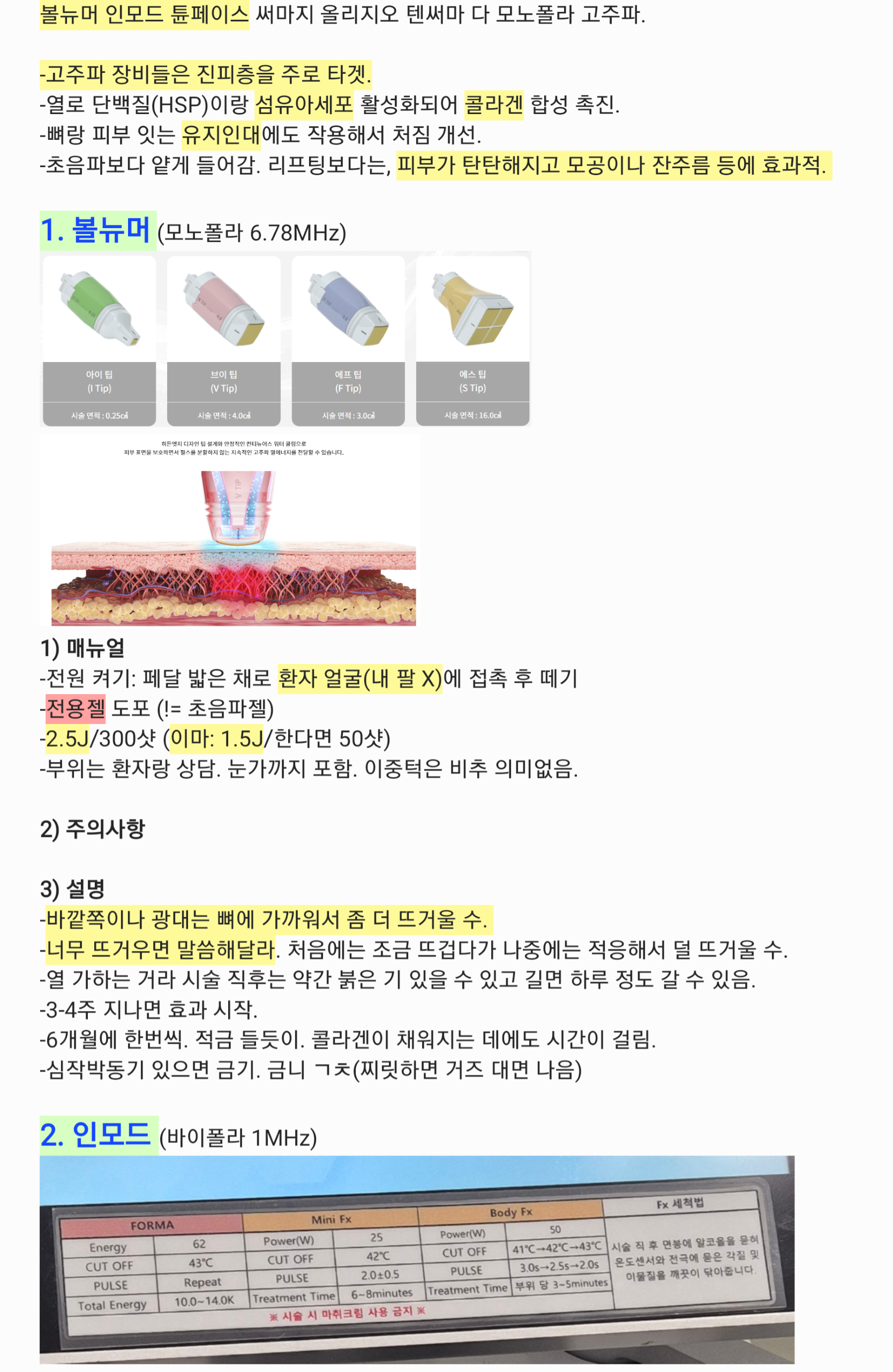 볼뉴머 팁별 작용 다이어그램 + 인모드 세팅표